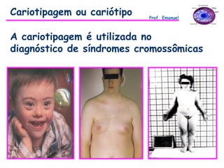 A cariotipagem é utilizada no
diagnóstico de síndromes cromossômicas
Cariotipagem ou cariótipo Prof. Emanuel
 