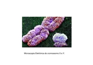 Microscopia Eletrônica do cromossomo X e Y.
 