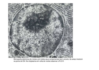Micrografia eletrônica do núcleo com todos seus componentes bem visíveis. As setas mostram
os poros do EN. No citoplasma em volta do núcleo observar o R.E.R.
 