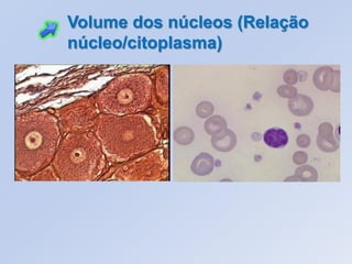 Volume dos núcleos (Relação
núcleo/citoplasma)
 