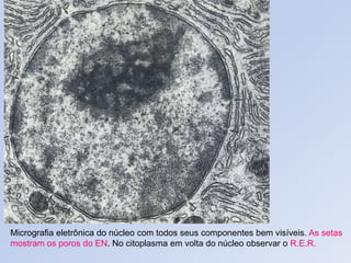 Micrografia eletrônica do núcleo com todos seus componentes bem visíveis. As setas
mostram os poros do EN. No citoplasma em volta do núcleo observar o R.E.R.
 
