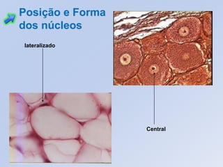 lateralizado
Central
Posição e Forma
dos núcleos
 