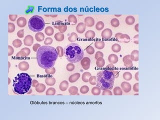 Glóbulos brancos – núcleos amorfos
Forma dos núcleos
 