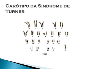 Slides Núcleo celular - Caroline Cerqueira Maciel