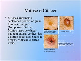 Mitose e Câncer Mitoses anormais e aceleradas podem originar tumores malignos (Neoplasia/Câncer). Muitos tipos de câncer não têm causas conhecidas e outros estão associados a drogas, radiação e certos vírus. 