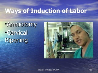 Ways of Induction of Labor Amniotomy Cervical Ripening 