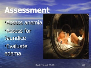 Assessment Assess anemia  Assess for Jaundice Evaluate edema 