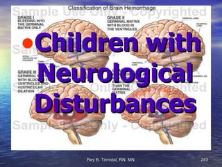 Children with Neurological Disturbances 