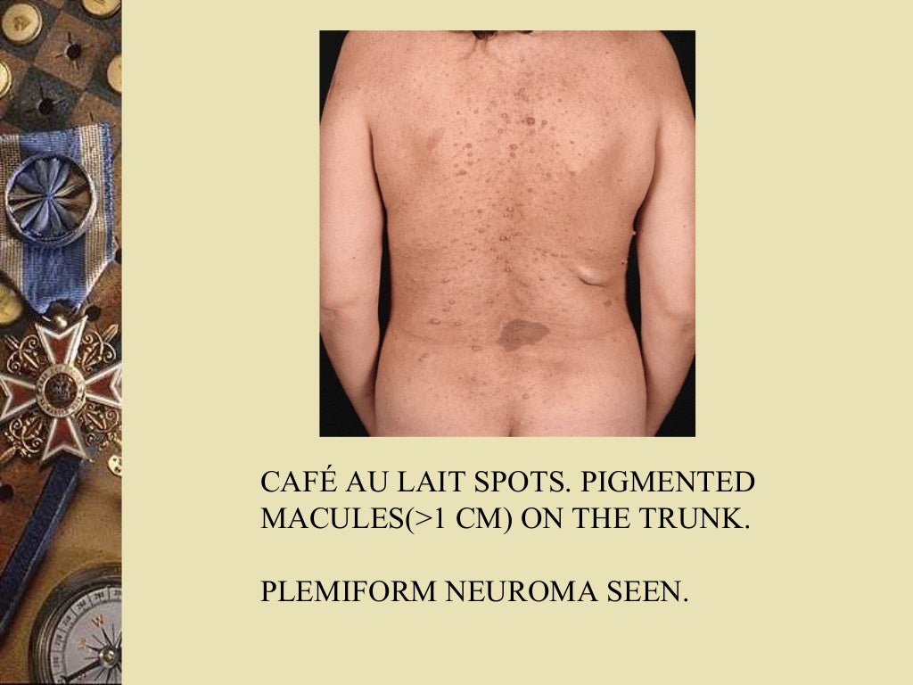 neuro cutaneous markers