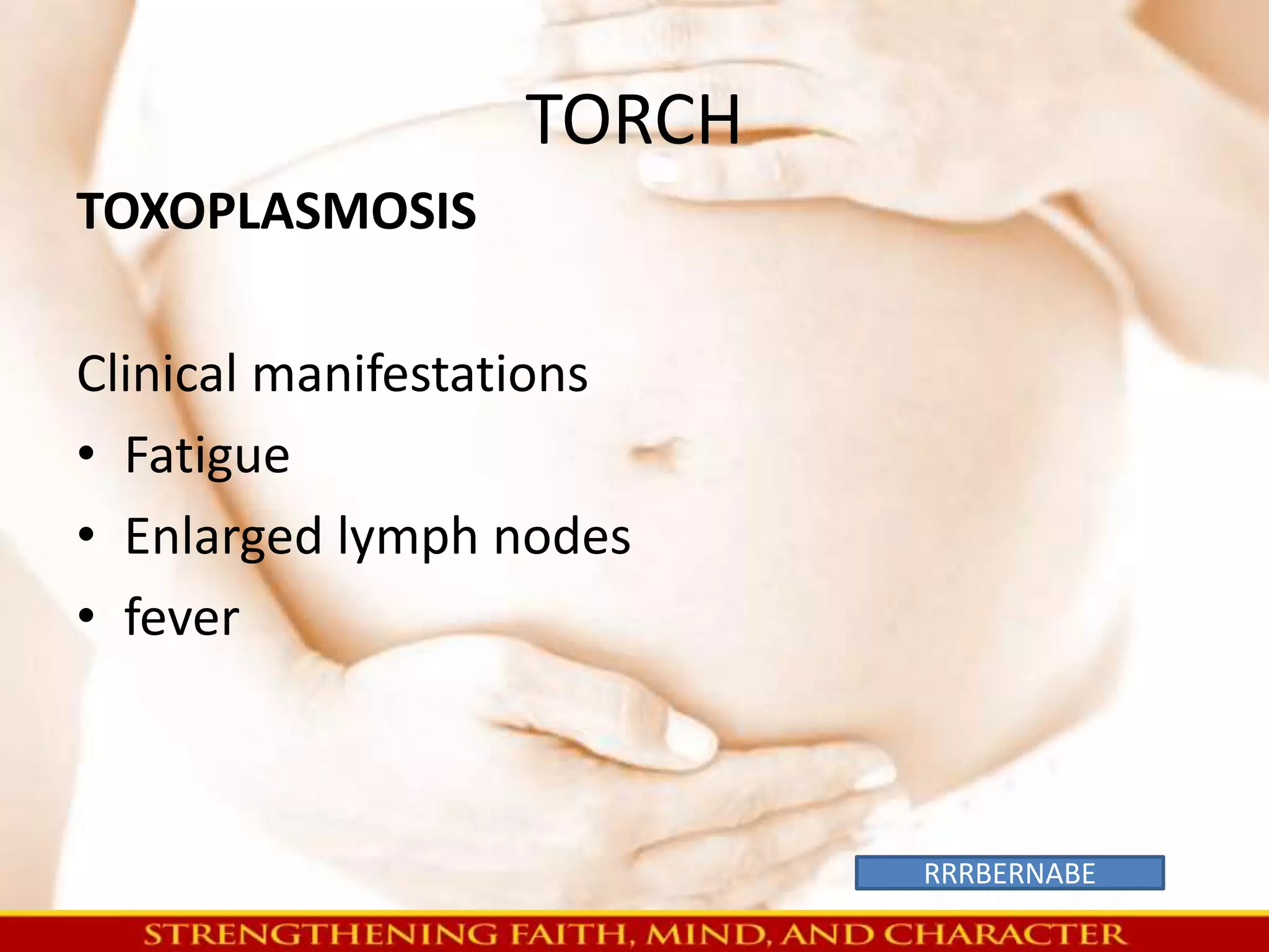 TORCH 
TOXOPLASMOSIS 
Clinical manifestations 
• Fatigue 
• Enlarged lymph nodes 
• fever 
RRRBERNABE 
 