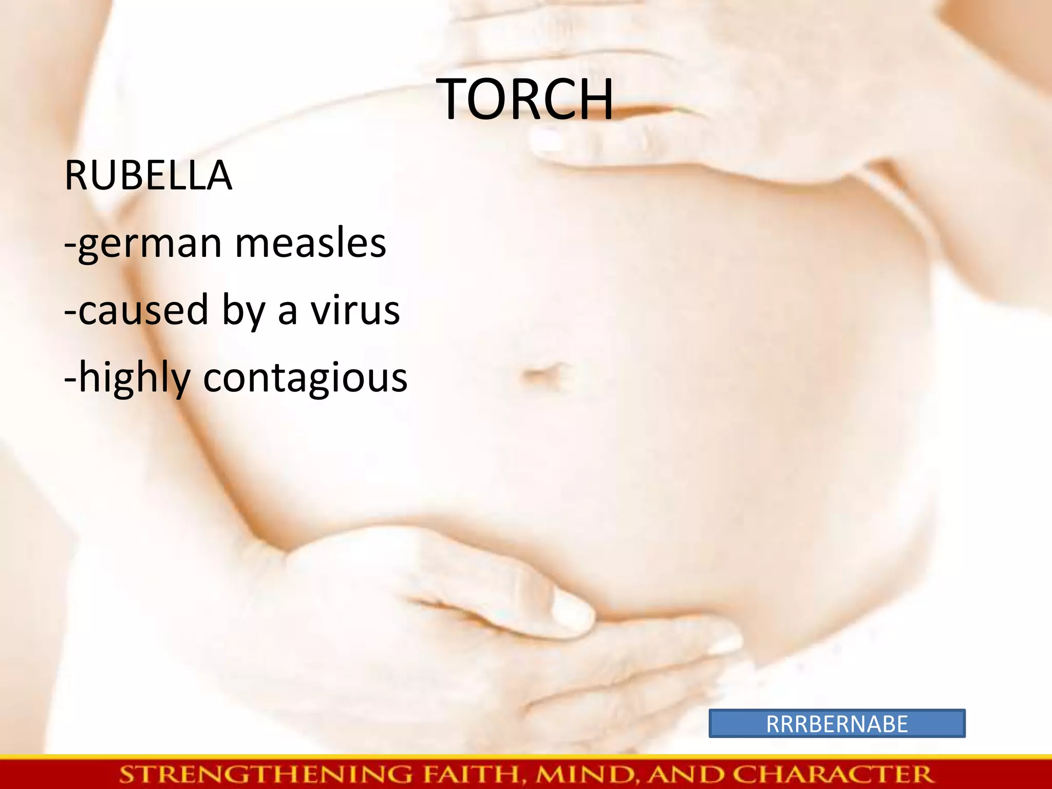 TORCH 
RUBELLA 
-german measles 
-caused by a virus 
-highly contagious 
RRRBERNABE 
 