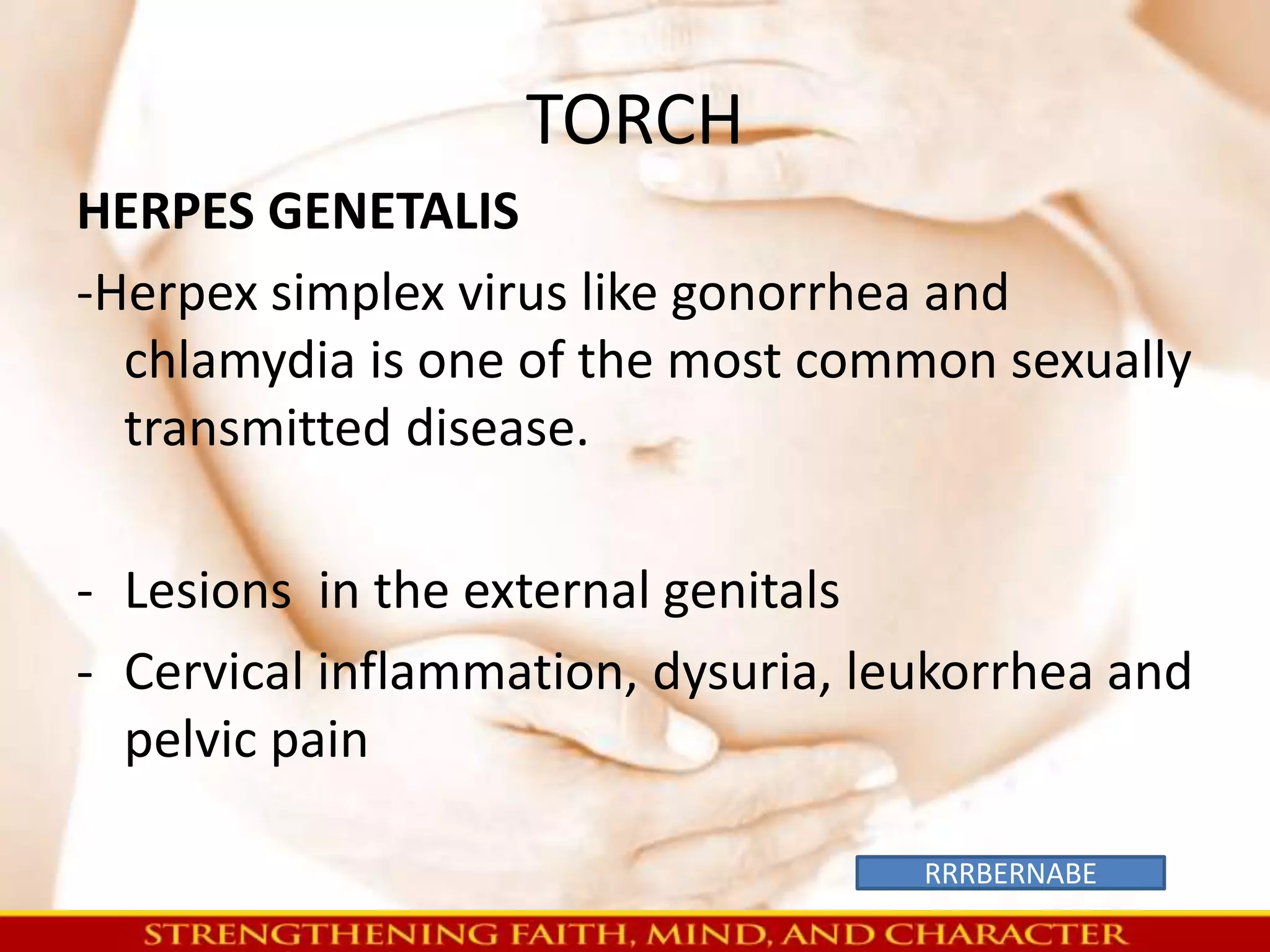 TORCH 
HERPES GENETALIS 
-Herpex simplex virus like gonorrhea and 
chlamydia is one of the most common sexually 
transmitted disease. 
- Lesions in the external genitals 
- Cervical inflammation, dysuria, leukorrhea and 
pelvic pain 
RRRBERNABE 
 