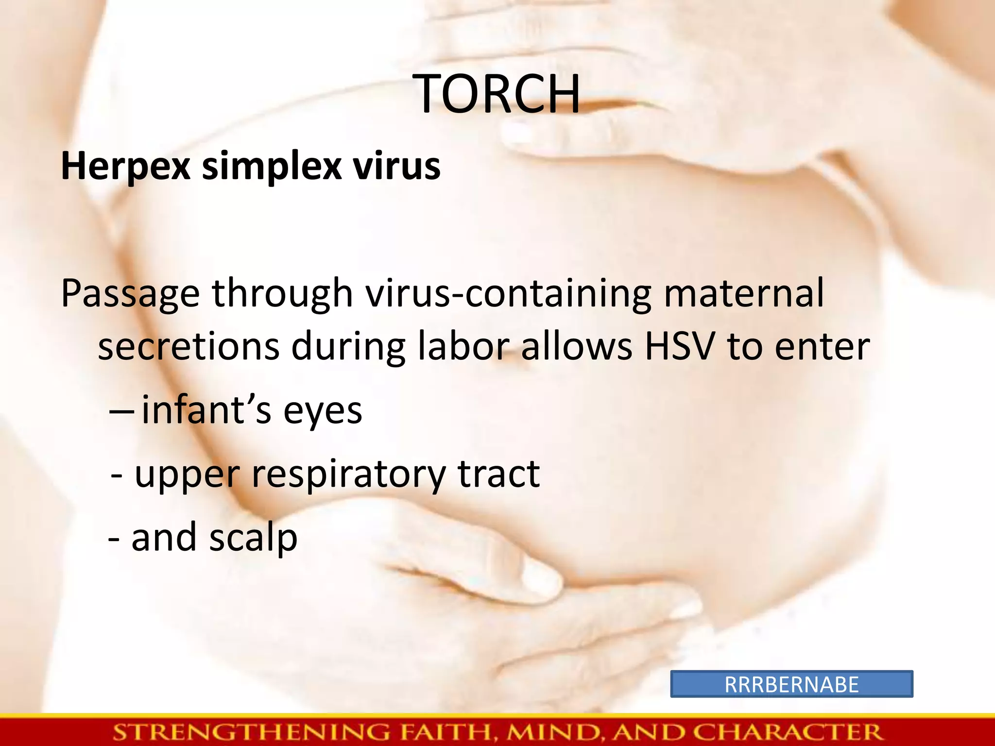 TORCH 
Herpex simplex virus 
Passage through virus-containing maternal 
secretions during labor allows HSV to enter 
– infant’s eyes 
- upper respiratory tract 
- and scalp 
RRRBERNABE 
 