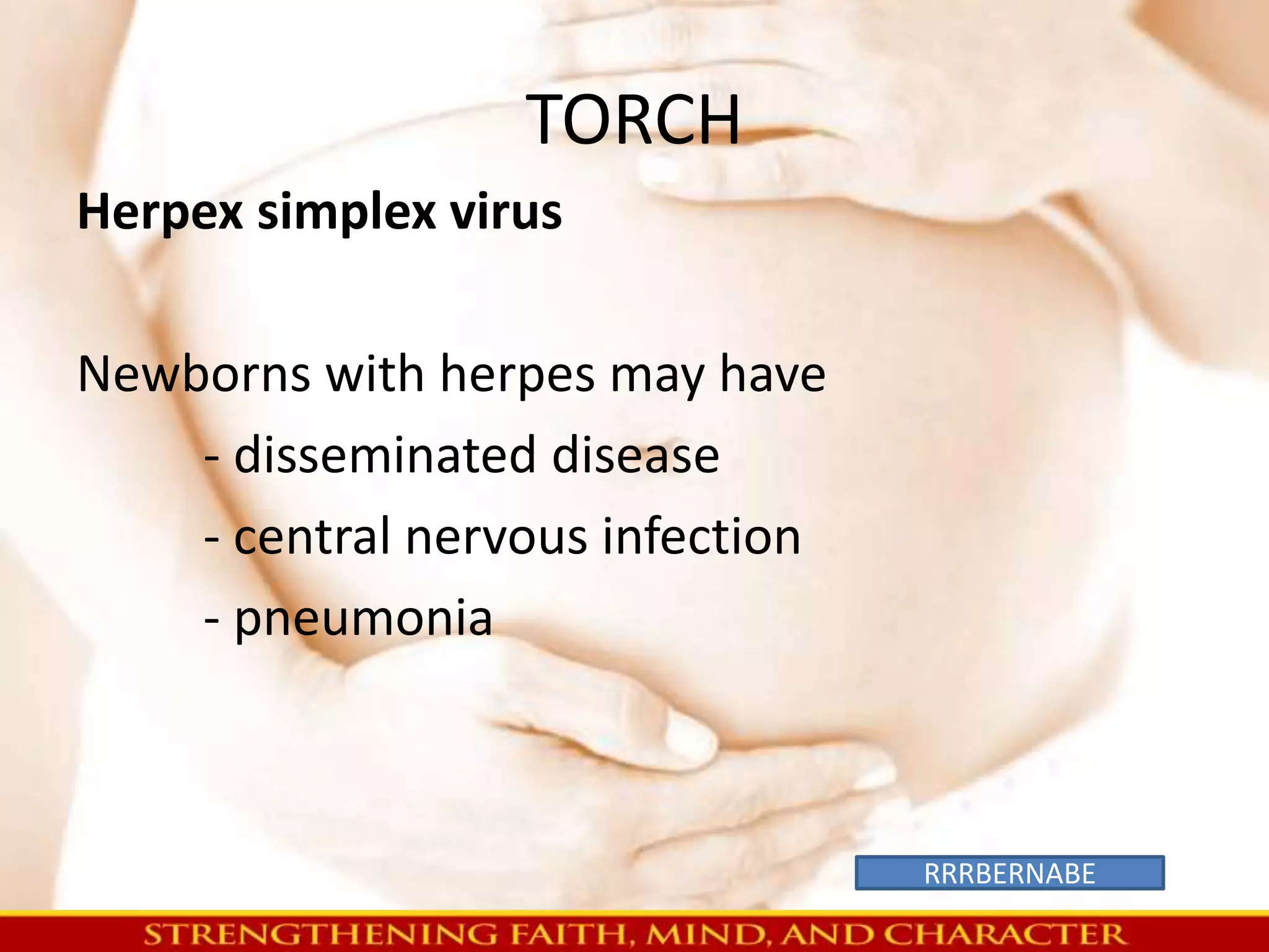 TORCH 
Herpex simplex virus 
Newborns with herpes may have 
- disseminated disease 
- central nervous infection 
- pneumonia 
RRRBERNABE 
 