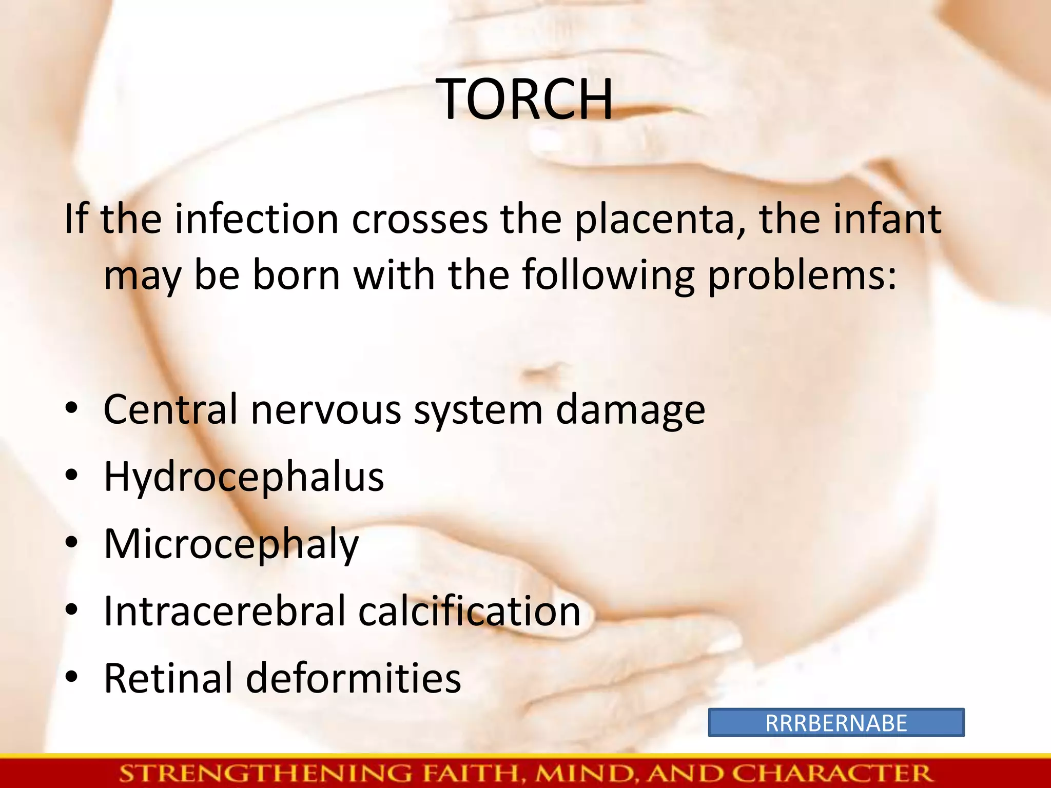 TORCH 
If the infection crosses the placenta, the infant 
may be born with the following problems: 
• Central nervous system damage 
• Hydrocephalus 
• Microcephaly 
• Intracerebral calcification 
• Retinal deformities 
RRRBERNABE 
 