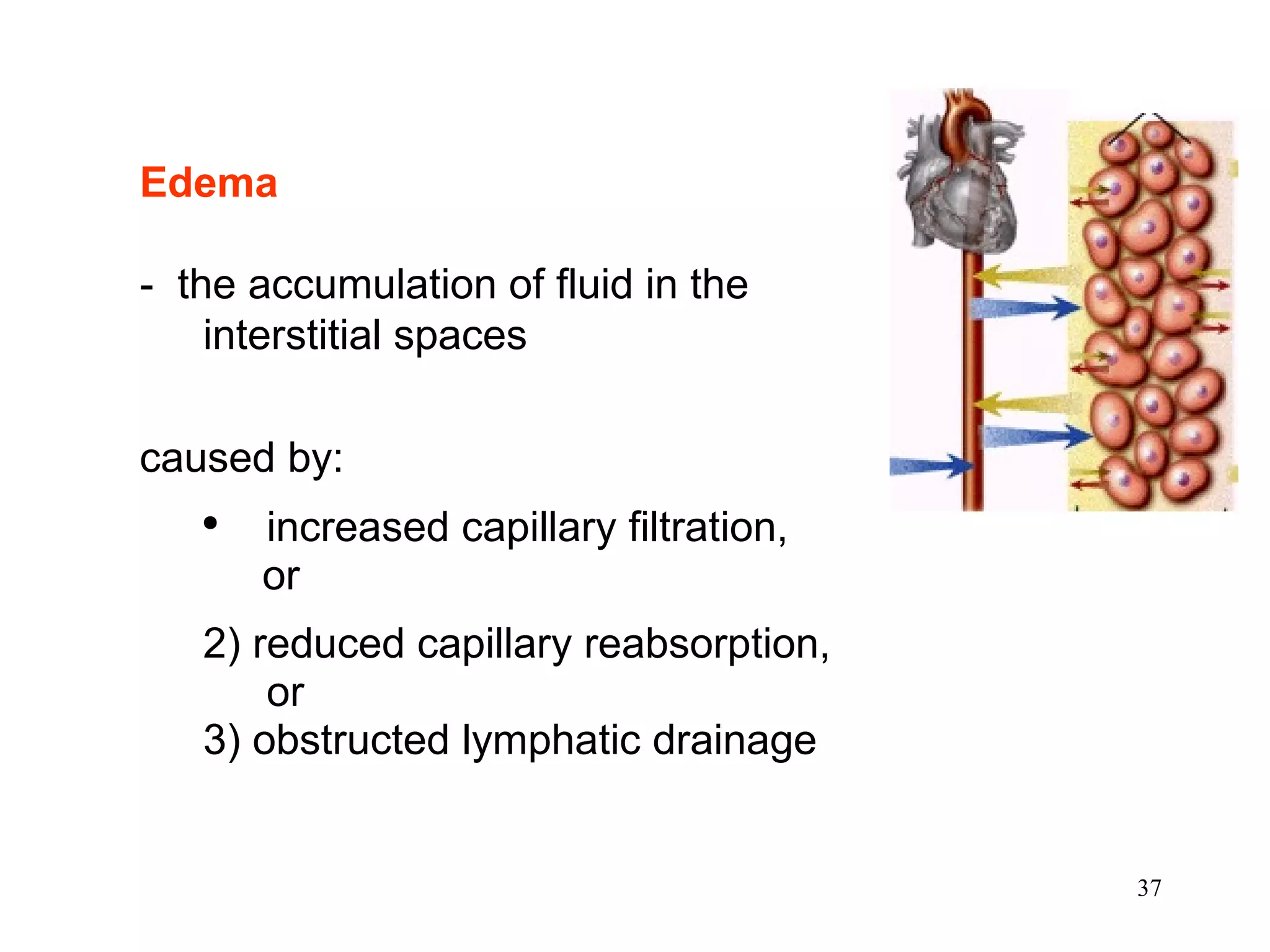 Edema -  the accumulation of fluid in the interstitial spaces caused by: increased capillary filtration,  or 2) reduced capillary reabsorption, or 3) obstructed lymphatic drainage   