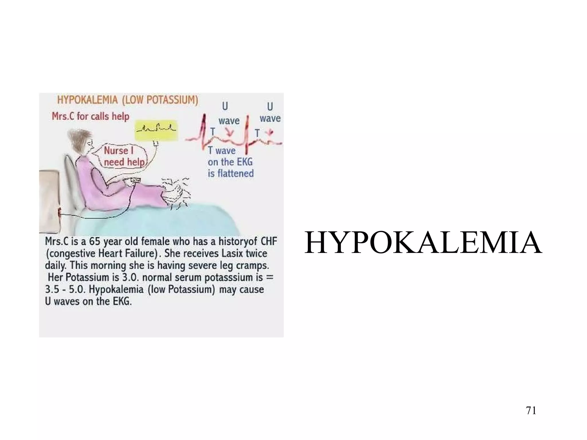HYPOKALEMIA 