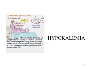 HYPOKALEMIA 
