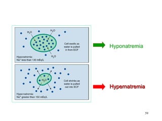 Hyponatremia




Hypernatremia



               59
 