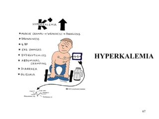 HYPERKALEMIA




         67
 