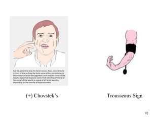 (+) Chovstek’s   Trousseaus Sign


                                   92
 