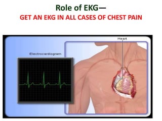 Role of EKG—
GET AN EKG IN ALL CASES OF CHEST PAIN
 