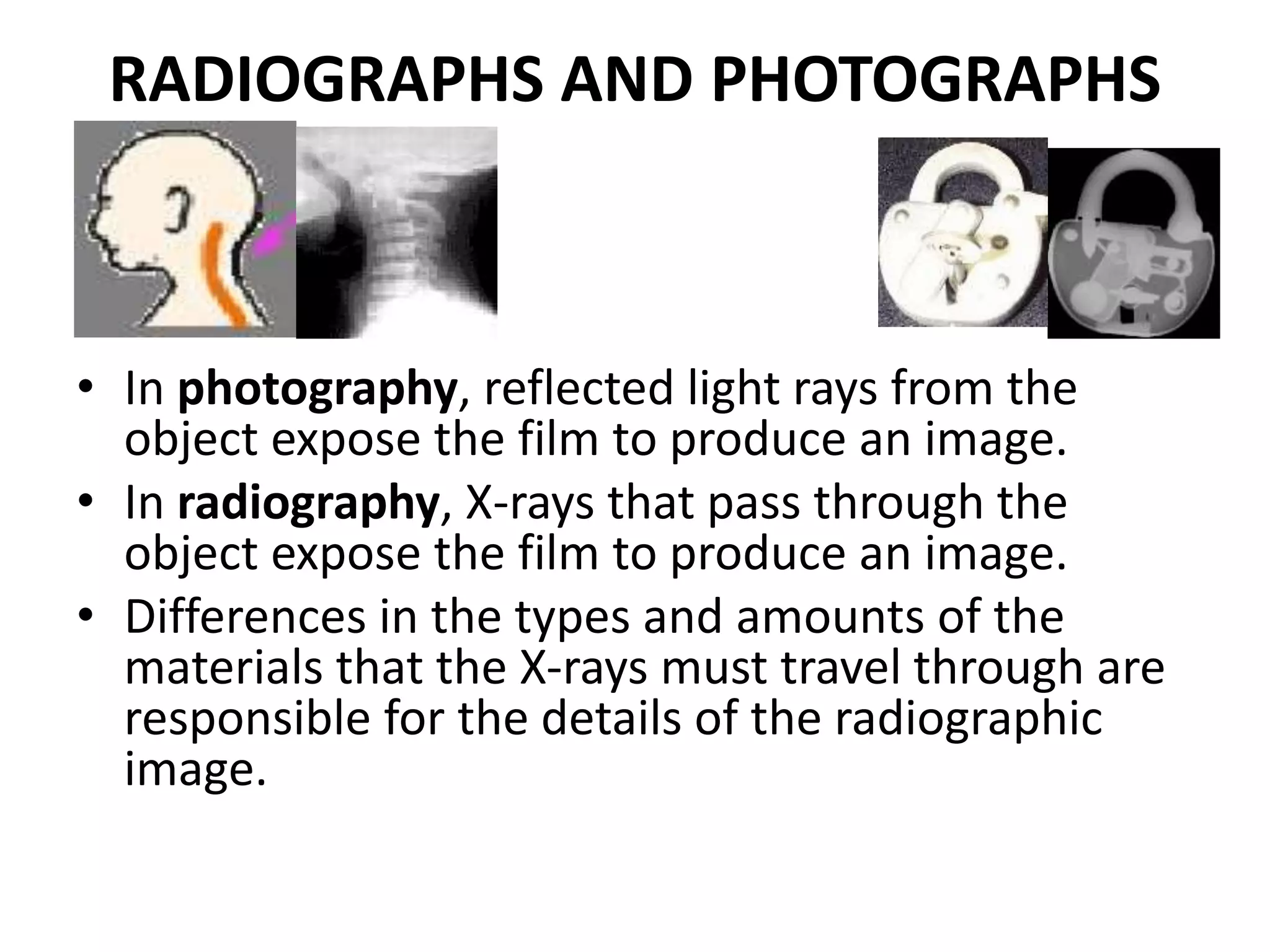 RADIOGRAPHS AND PHOTOGRAPHS
• In photography, reflected light rays from the
object expose the film to produce an image.
• In radiography, X-rays that pass through the
object expose the film to produce an image.
• Differences in the types and amounts of the
materials that the X-rays must travel through are
responsible for the details of the radiographic
image.
 