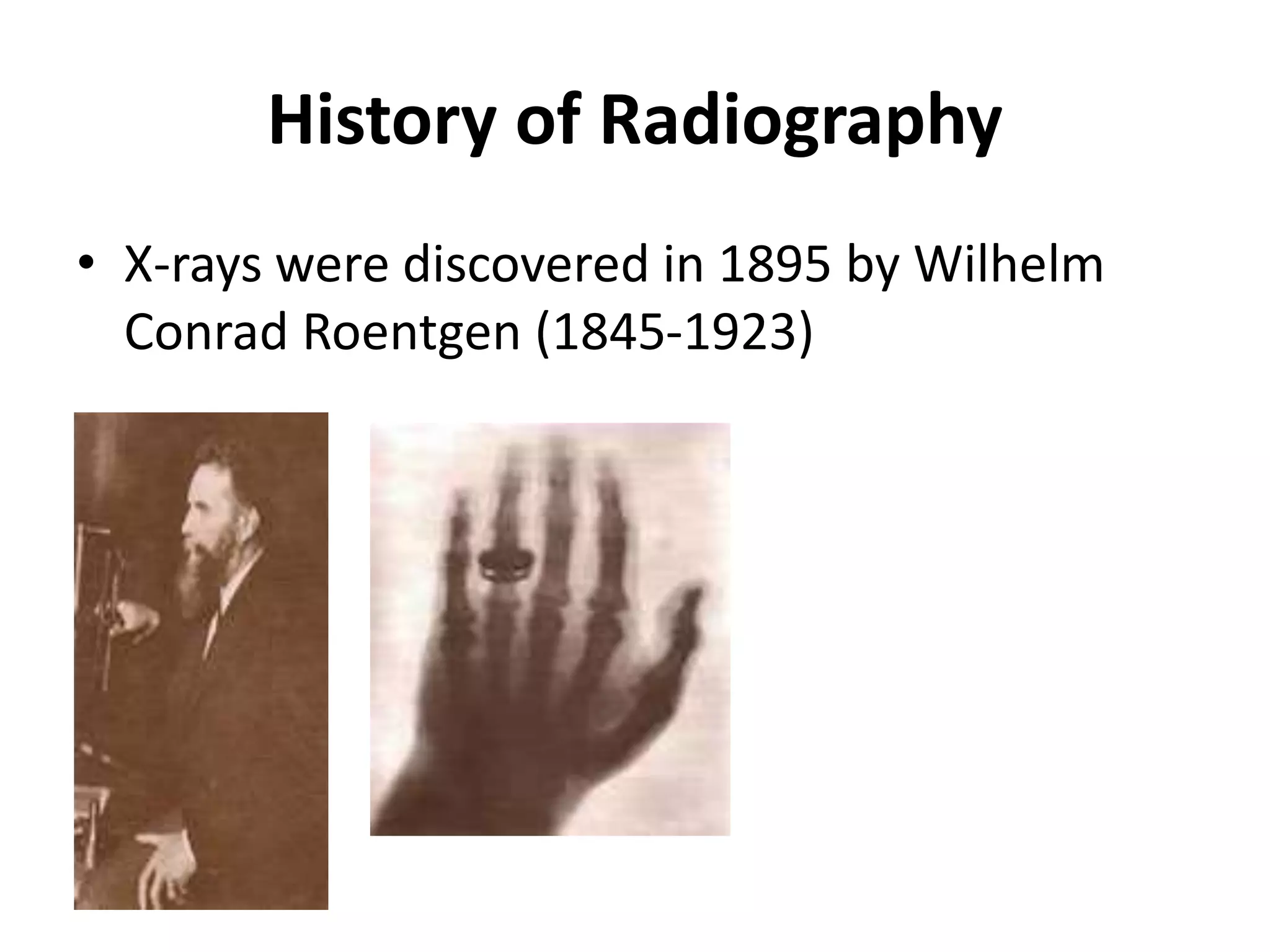 History of Radiography
• X-rays were discovered in 1895 by Wilhelm
Conrad Roentgen (1845-1923)
 
