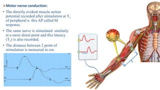 Nerve conduction studies