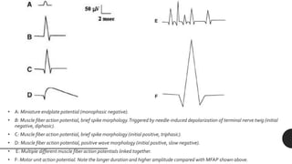 Triphasic Action Potential NERVE CONDUCTION STUDIES, ELECTROMYOGRAPHY | PPTX