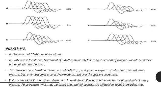 nerve conduction studies electromyography electromyography