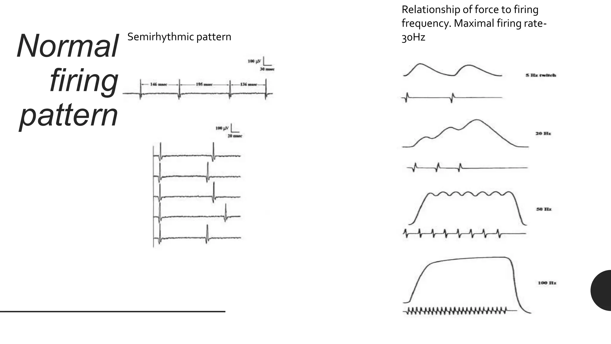 Normal
firing
pattern
Semirhythmic pattern
Relationship of force to firing
frequency. Maximal firing rate-
30Hz
 