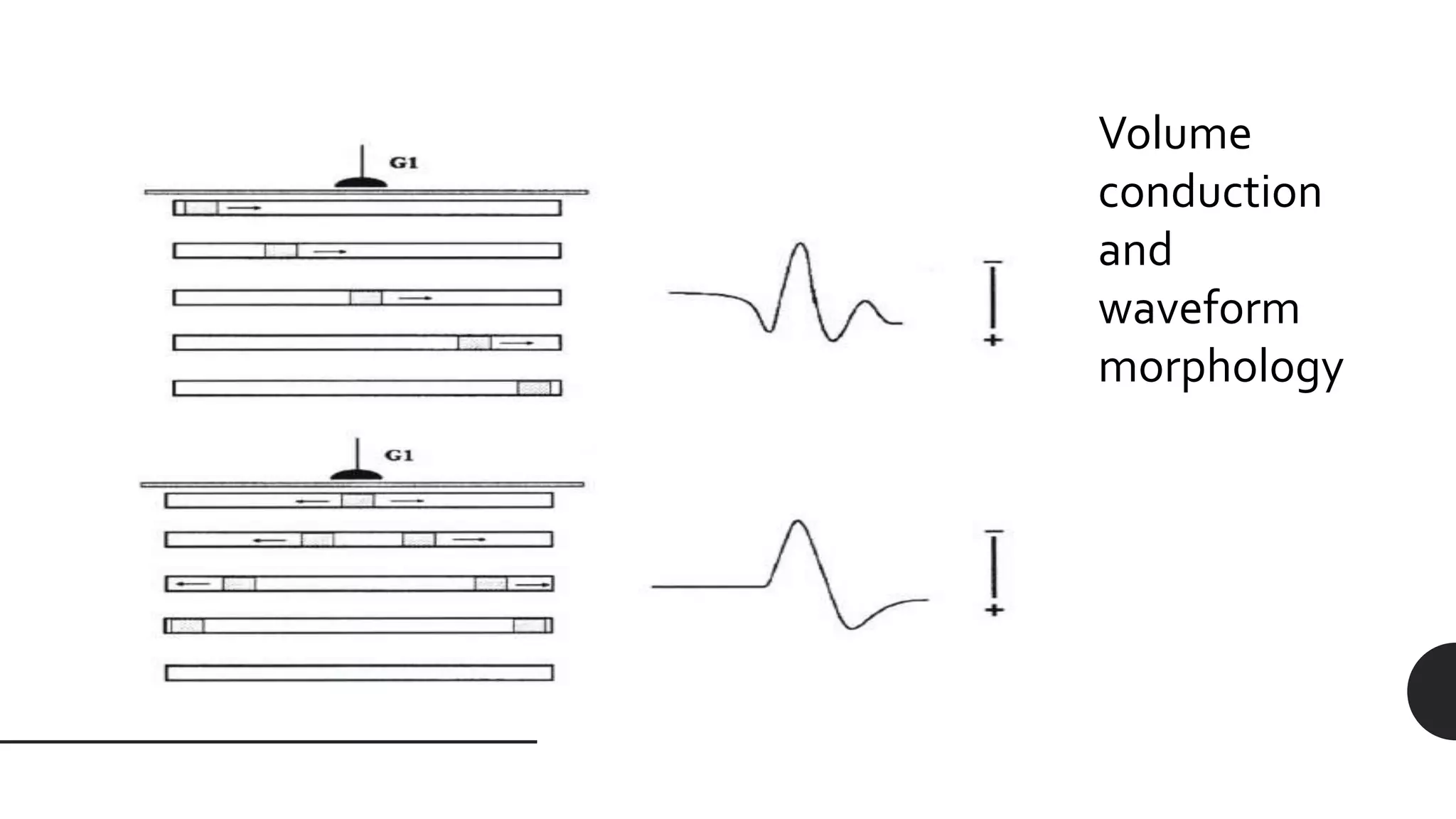 Volume
conduction
and
waveform
morphology
 