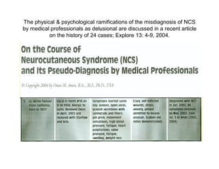 The physical & psychological ramifications of the misdiagnosis of NCS
by medical professionals as delusional are discussed in a recent article
          on the history of 24 cases; Explore 13: 4-9, 2004.
 