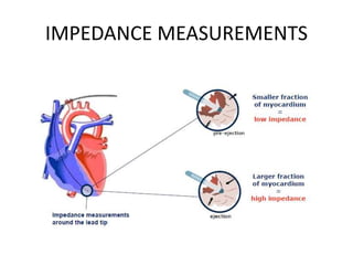 IMPEDANCE MEASUREMENTS
 