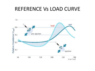 REFERENCE Vs LOAD CURVE
 