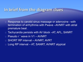 approach to narrow comlex tachycardia | PPTX