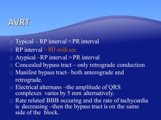 What Is Rp Interval APPROACH TO NARROW COMPLEX TACHYCARDIA | PPTX