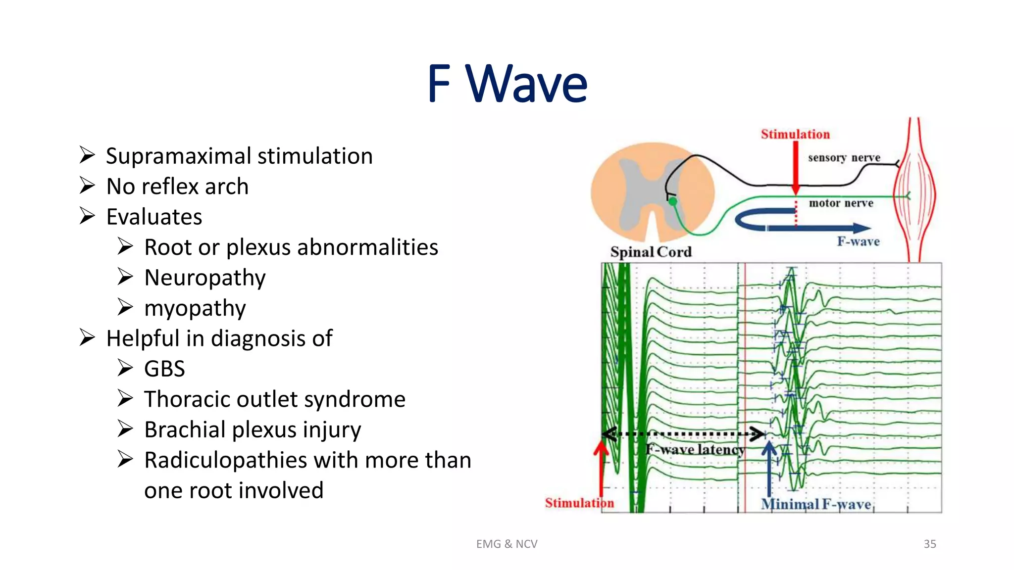 NCV and EMG.pptx