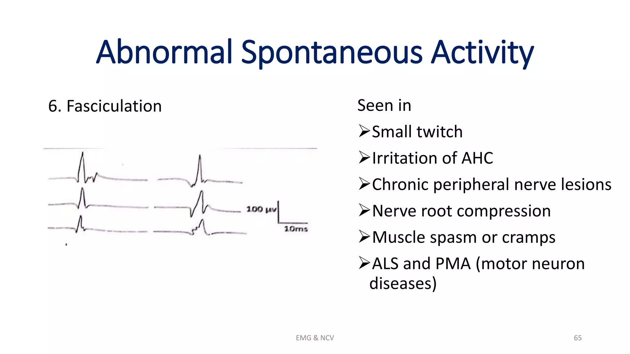 NCV and EMG.pptx