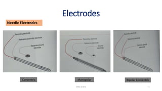 Electrodes
EMG & NCV 11
Concentric Monopolar Bipolar Concentric
Needle Electrodes
 