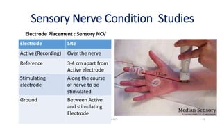 Sensory Nerve Condition Studies
Electrode Placement : Sensory NCV
EMG & NCV 22
Electrode Site
Active (Recording) Over the nerve
Reference 3-4 cm apart from
Active electrode
Stimulating
electrode
Along the course
of nerve to be
stimulated
Ground Between Active
and stimulating
Electrode
 