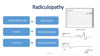 Radiculopathy
EMG & NCV 40
CMAP AMPLITUDE
F WAVE
H REFLEX REDUCED/ABSENT
REDUCTION
REDUCED/ABSENT
 