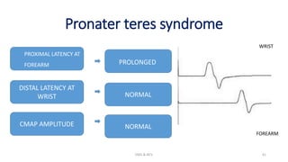 Pronater teres syndrome
EMG & NCV 41
PROXIMAL LATENCY AT
FOREARM
DISTAL LATENCY AT
WRIST
CMAP AMPLITUDE
FOREARM
WRIST
PROLONGED
NORMAL
NORMAL
 