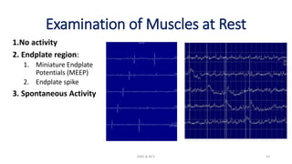Examination of Muscles at Rest
1.No activity
2. Endplate region:
1. Miniature Endplate
Potentials (MEEP)
2. Endplate spike
3. Spontaneous Activity
EMG & NCV 53
 