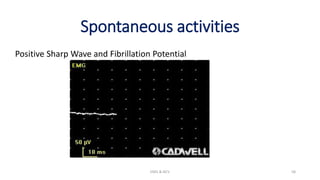 Spontaneous activities
Positive Sharp Wave and Fibrillation Potential
EMG & NCV 58
 