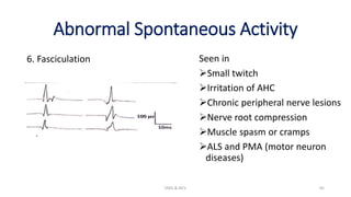 Abnormal Spontaneous Activity
6. Fasciculation
EMG & NCV 65
Seen in
Small twitch
Irritation of AHC
Chronic peripheral nerve lesions
Nerve root compression
Muscle spasm or cramps
ALS and PMA (motor neuron
diseases)
 