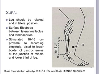 SURAL 
 Leg should be relaxed 
and in lateral position. 
 Surface Electrode-between 
lateral malleolus 
and tendoachilles. 
 Stimulated 10-16 cm 
proximal to recording 
electrode, distal to lower 
border of gastrocnemius 
at the junction of middle 
and lower third of leg. 
Sural N conduction velocity- 50.9±5.4 m/s, amplitude of SNAP 18±10.5μV 
 