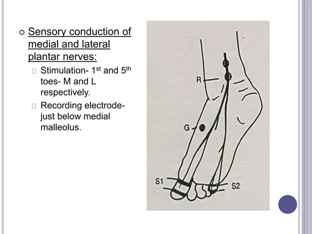 Nerve Conduction Studies- Lower Leg | PPTX