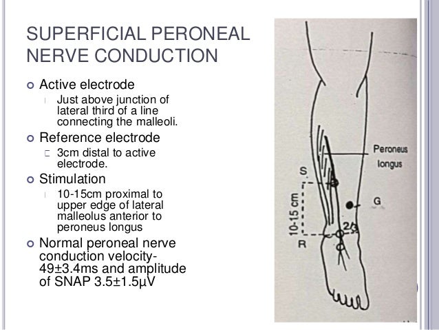 Nerve Conduction Studies Lower Leg